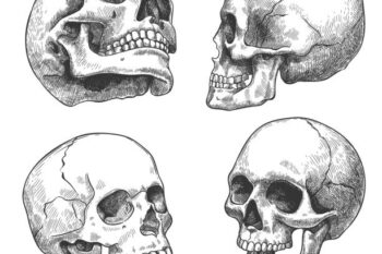 COME APPAIONO LE LESIONI DA ARMA DA FUOCO SU UN OSSO PIATTO 10